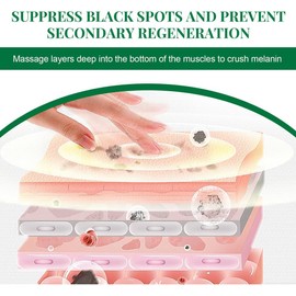 Suero Facial con Nicotinamida, Corrector de Manchas Oscuras, Elimina Pecas y Acné, Mejora la Melanina, Brillo para Rostro Opaco (1 PCS)