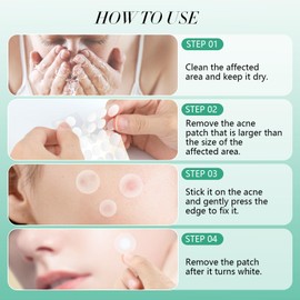 72 Pcs Pimple Patches, Invisible Spot Cover for Face and Body, Medical-Grade Hydrocolloid for Fast Healing, Absorbs Excess Oil and Reduces Redness, Gentle for All Skin Types Travel Work Overnight Use