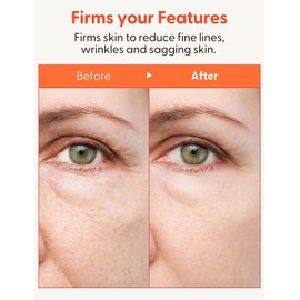 It'S SKIN (Serum) - It'S SKIN Collagen Nutrition Serum 40ml 1.35 fl. Oz. - Serum Skin Treatment Anti Ageing Facial Wrinkle Night Antioxidant Moisturiser Hydroboost Softener