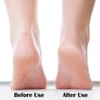 Nano Foot File, Foot Scrubber Callus Remover, Foot Care Pedicure