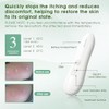 Insect Sting and Bite Relief Electronic Heat Device for After