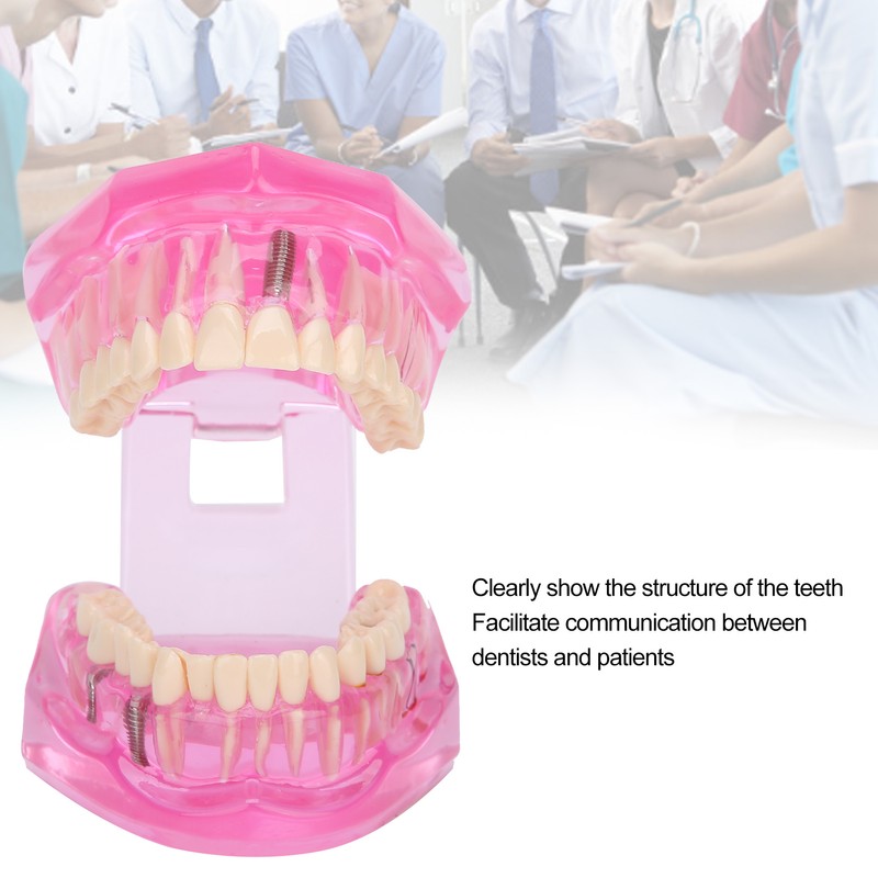 Transparent Adult Teeth Model Pathological Repair Studying Dental Teaching Tools