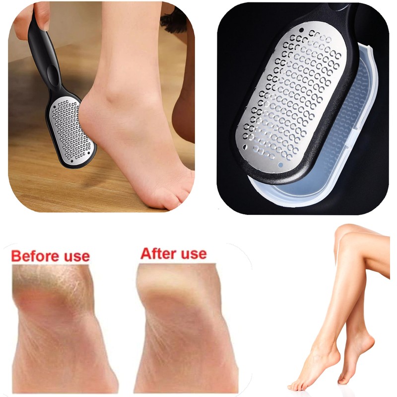 Heel Exfoliating Foot Care Stainless Steel Foot Exfoliating Remover File