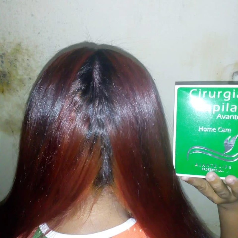 Generic ESCOVA CIRURGIA CAPILAR SELAGEM AVANTE LIFE Profissional Capilar Home