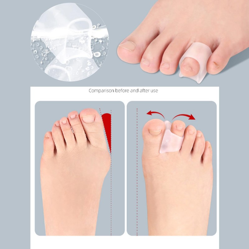 10 Pcs Hammer Toes Corrector Toe Splints, Gel Toe Straighteners