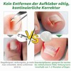 144 x Nail Clips/Toenails/Nail Correction Clips Toenail 4 x 24