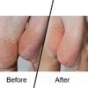 FNX Original Emjoi Micro Pedi Coarse Micro-Mineral Rollers | Cracked,