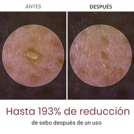 Dr.Melaxin Peel Shot Glow - Ampolla peladora de arroz blanco con extracto de arroz y AHA BHA, suero exfoliante brillante y suave para control de sebo,