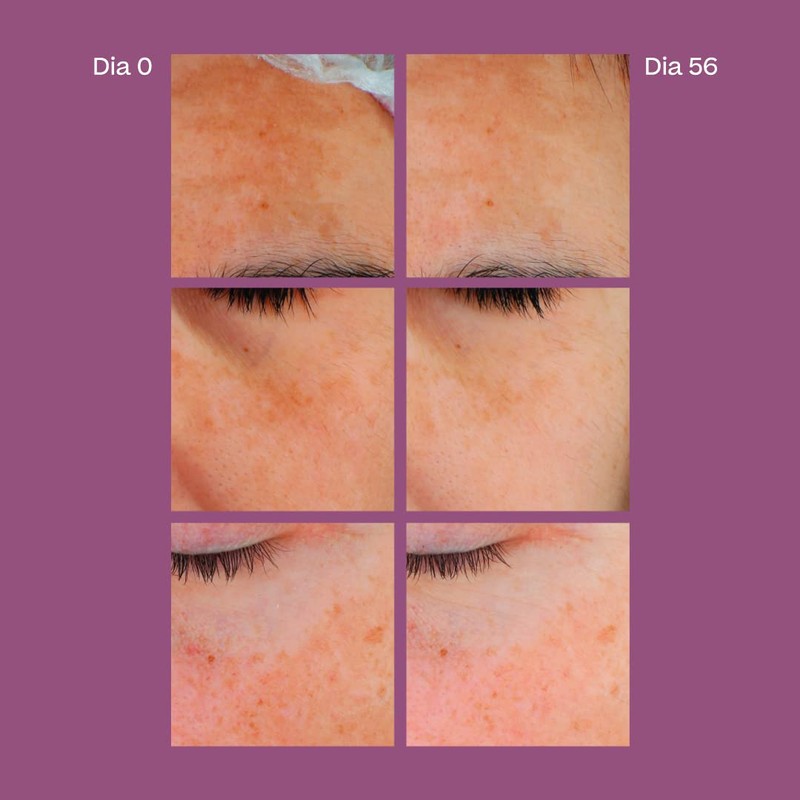 Skin D-Pigment [Serum ATX B3] Corrective Treatment 30 ml