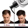 Om Style - Kit Crecimiento Capilar + Anticaída 2 Hair