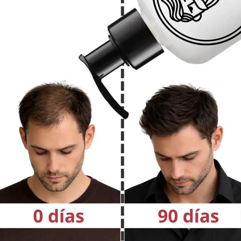 Om Style - Kit Crecimiento Capilar + Anticaída 2 Hair