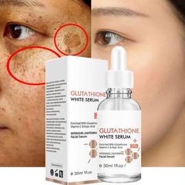 KOAHDE Whitening Freckle Serum, Glutathione Skin Whitening Serum, Dark Spots Brightener, Face Serum Reduces Dark Spots, Glutathione Whitening Face Serum, Whitening Blemish Serum, 1 Piece