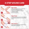Care Science Gauze Pads, 20 ct, Large, 4 X 4