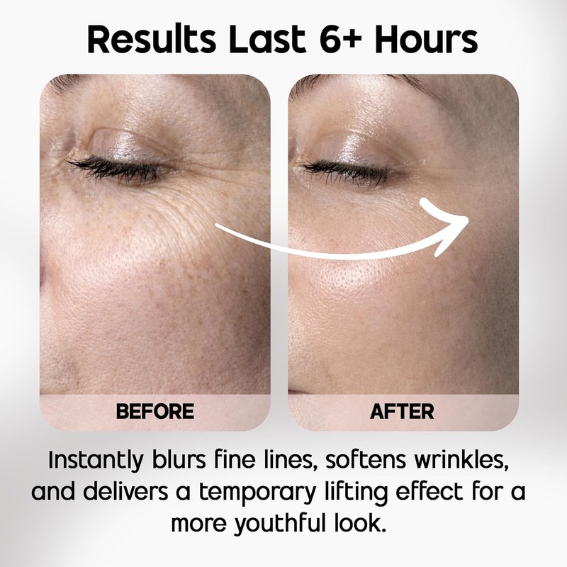 Celestolite Estrella Anti-Wrinkle Syringe