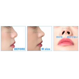 CatMoz 3D Nose Petite 5 Sizes for Improved Dumpling Nose, Pig Nose, Garlic Nose, Pain Free Orthopedic Nose, 1 Box of 2 Sizes (ML, 2 Sizes)