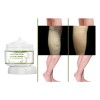 Crema Reparadora, Reductora Varices, Varicosa, Flebitis, Dol