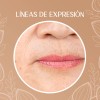 Crema Despigmentante Para Manchas, Melasma, Acné Y Paño