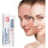 Gel Retinoide Tópico Para El Tratamiento Del Acné