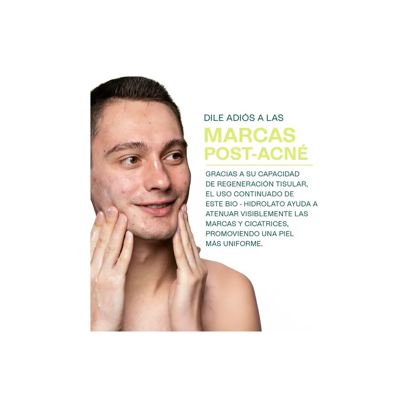 Hidrolato De Centella Asiática Reparador, Cicatrizante120 Ml