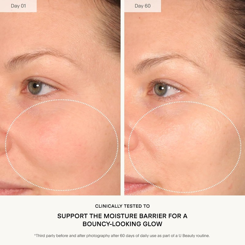 The Barrier Tratamiento bioactivo