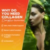 Collagen Complex Gummies for Women & Men, 500mg Collagen with