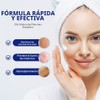 Eliminador Manchas Oscuras Mujeres Hombres Crema Correctora Mágica Todas Pieles