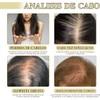 3 Piezas Aceite Natural Para el Crecimiento del Cabello, Aceite