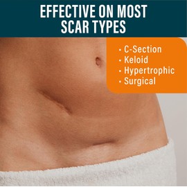 NUVADERMIS Nuvadermis Láminas De Silicona Para Cicatrices - Hojas Extra Largas Para Cicatrices Para Cesárea, Abdominoplastia, Queloide Y Cicatrices Quirúrgicas - Hojas De Silicona Reutilizab