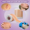 Rayyl Silicone Scar Sheets (1.6" x 60" Roll - 1.5M)