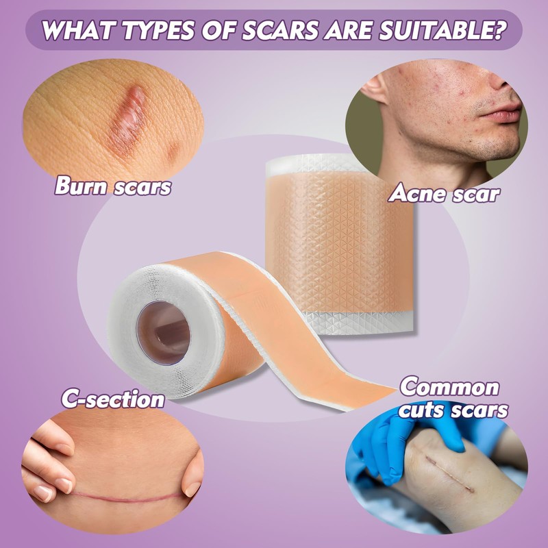 Rayyl Silicone Scar Sheets (1.6" x 60" Roll - 1.5M)