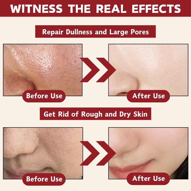 Rice Ampoule Duo, 2PCS Rice Exfoliating Set