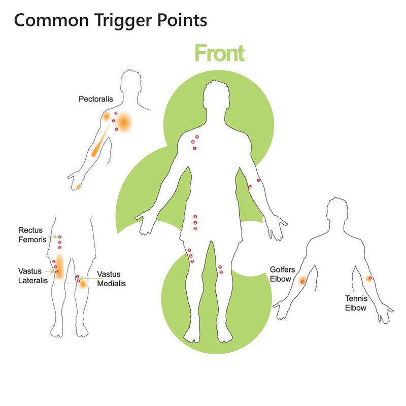 LOCKEROOM Pocket Physio Muscle Trigger Triangle, Pressure Point Release, Relieve