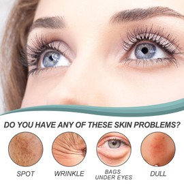 Pigmentflecken Entferner, Whitening Cream, Creme Gegen Pigmentflecken, Anti-Ageing-Creme für dunkle Flecken im Gesicht, Altersflecken Entfernen, Flecken Creme Aufhellende Creme cream set