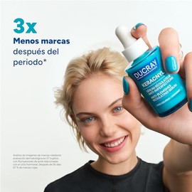 DUCRAY Keracnyl Srum Regulador Anti-Imperfecciones, Controla brotes de imperfecciones agravados por el ciclo hormonal, la alimentacin y el estrs, 30ml