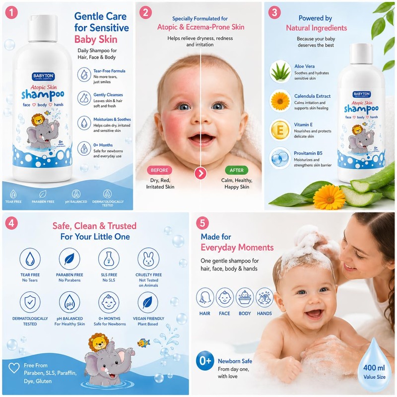 Babyton Atopic Skin Shampoo for Babies 400ml – Gentle, Natural