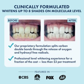 LIVFRESH Teeth Whitening Strips, 28 Strips, 14 Treatments, Great for Sensitive Teeth, Results in 14 Days, Enamel Safe, Coconut Oil & Hydrogen Peroxide, No Slip Teeth Whitener