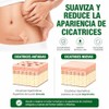 Parches Silicona Cicatrices Rollo Reutilizable Recortable Flexible Cómodo Grado Médico