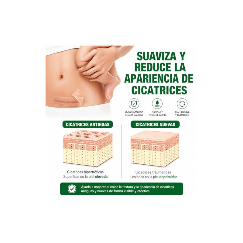 Parches Silicona Cicatrices Rollo Reutilizable Recortable Flexible Cómodo Grado Médico