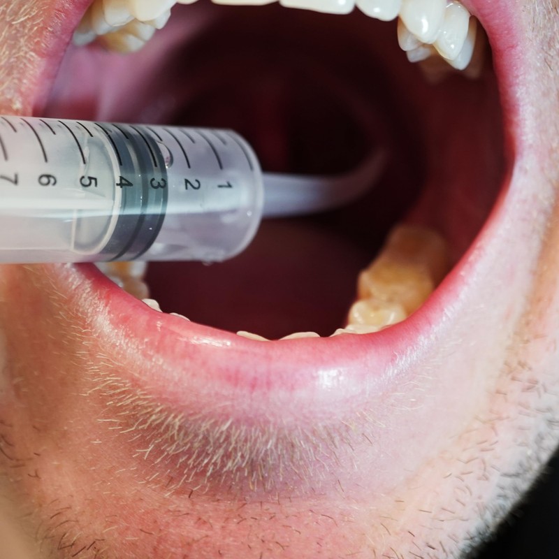 Generic Premium Tonsil Stone Remover Kit, Metallic