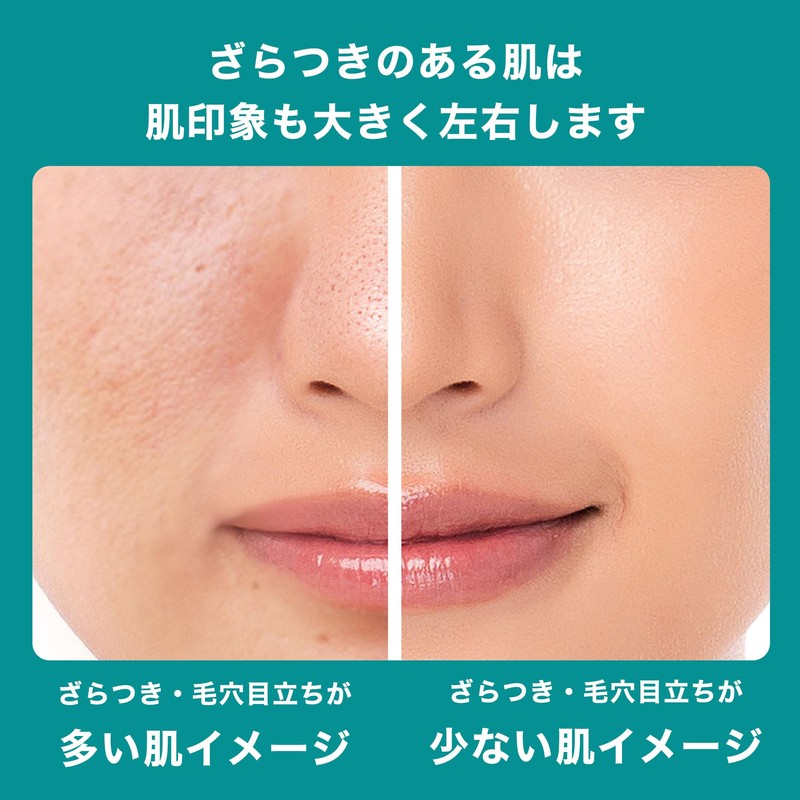 La Roche-Posay(ラロッシュポゼ) Effaclar Peel Care Serum, Exfoliating Care Serum for