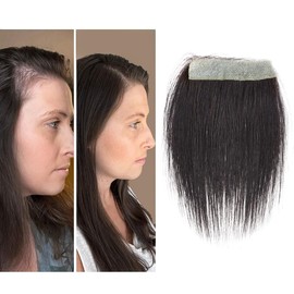 Meiverah scar human hair replacement Accidental burns without hair for men women Hairline Loss Straight Tape in Replacement Toupee(Natural Black, 0.78"x3")