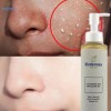 BIODERMAX LACTOBIONIC ACID EXFOLIATING GEL RADIANT SKIN 150ML Organic