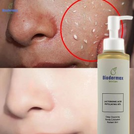 BIODERMAX LACTOBIONIC ACID EXFOLIATING GEL RADIANT SKIN 150ML Organic