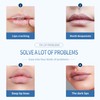 HBESTY Lip Repair Gel for Cracked & Dry Lips -