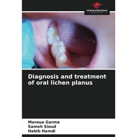 Diagnosis and treatment of oral lichen planus