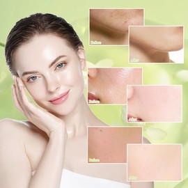 Fengyang Green Tea Skin Care Set, 6-in-1 Skin Care Set, Green Tea Face Care Set, Nourishes Anti-Ageing Skin Care Set, Moisturising Skincare Set for Teen Girls