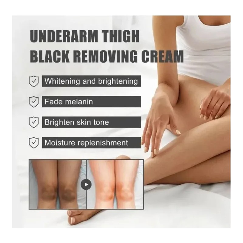 Tratamiento Cutaneo Blanqueador Zonas Obscuras Aclarante 50g