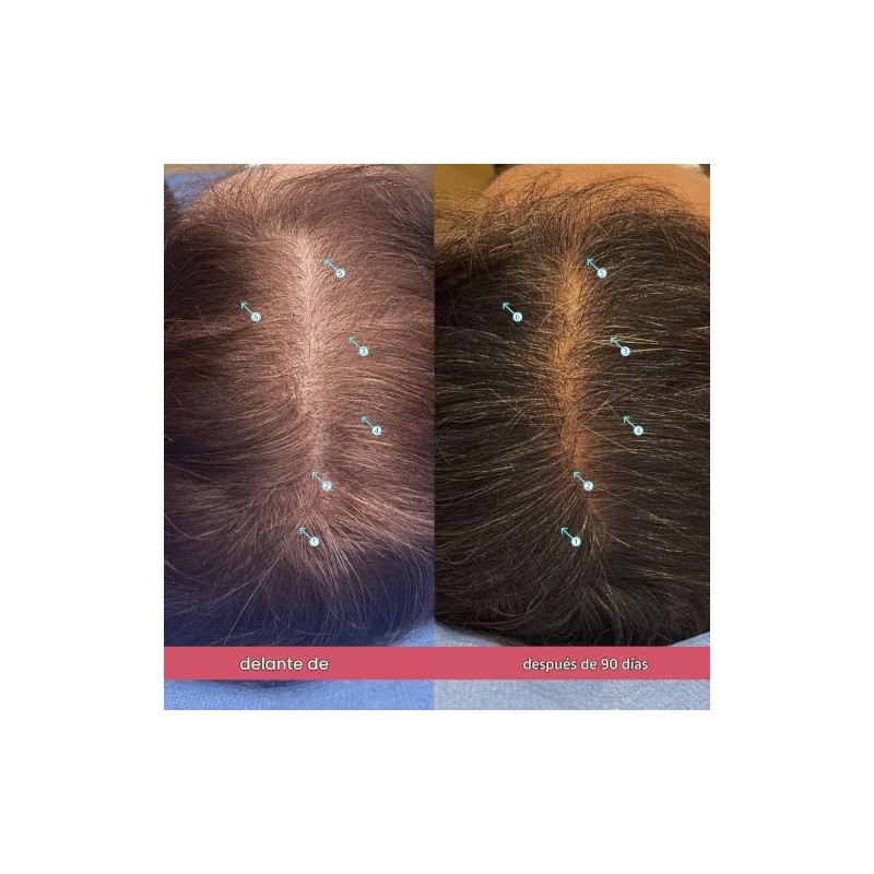 DS Laboratories Spectral.CSF Tratamiento de regeneración del cabello para mujeres,