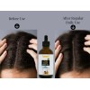 Ammuri Organic Black Seed Oil for Radiant Skin