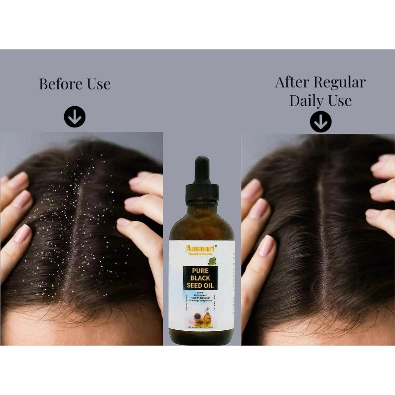 Ammuri Organic Black Seed Oil for Radiant Skin